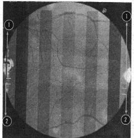 The Shutter of Death, Encyclopedia of Optography